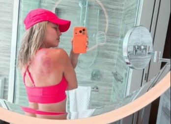 KARAMBA Renata osetila vrelinu australijskog sunca, a onda i moć Srpkinje